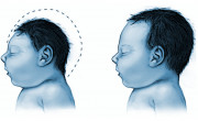 head size comparison blue