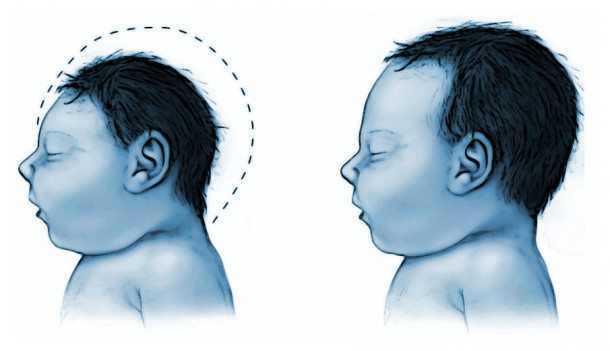 head size comparison blue